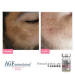 AGF Mesenquimal Pink - Image 6