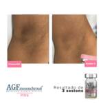 AGF Mesenquimal Pink - Image 2