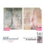 AGF Mesenquimal Pink - Image 5