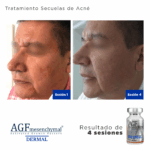 AGF Mesenchymal Dermal - 5 / 6ml ea - Image 2